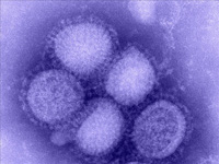 H1N1 Virus, Photo Credit: Courtesy: Abilene Christian University
