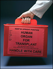 organ-transplant