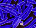 E. coli bacteria