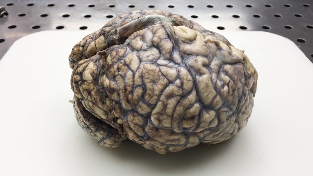 l_brain-2