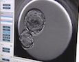 a human egg cell