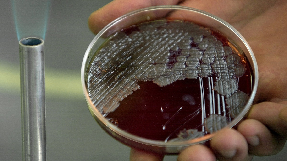  Chemistry student Jorge Rodriguez Martinez holds a sample of billions of Anthrax bacteria at the National School of Biological Sciences in Mexico City, Wednesday, Oct. 17, 2001. (AP Photo/Victor R. Caivano) 