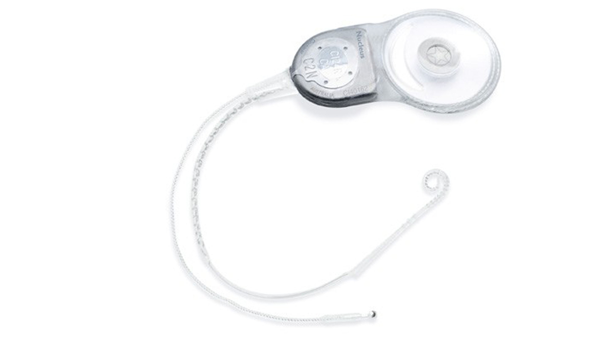  A cochlear implant is a small electronic device surgically placed in the inner ear that provides a sense of sound to the deaf and those with profound hearing loss (PRNewsFoto/AP Image) 
