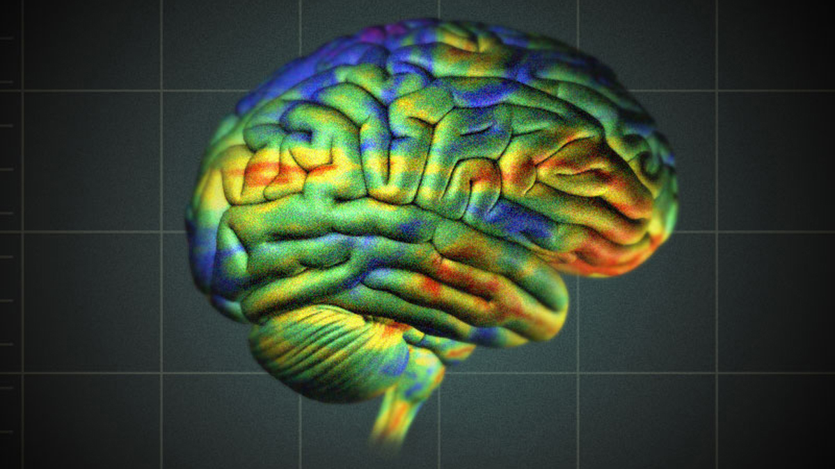  Researchers used neuroimaging techniques to map the nerve fibers that emanate from the retina and project into the primary visual cortex, the visual processing center of the brain. (V. Altounian/Science Translational Medicine) 