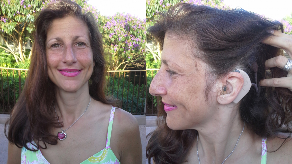 Karyn Reyher has a hybrid cochlear implant to account for her severe to profound hearing loss at high frequencies. (Kelly Reyher/for The Pulse)
