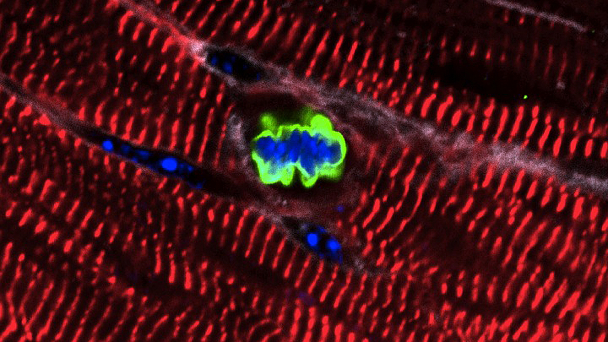  An adult heart muscle cell in a mouse re-enters the cell cycle after expression of a cluster of microRNAs. (Image courtesy Lab of Ed Morrisey, Perelman School of Medicine, University of Pennsylvania) 