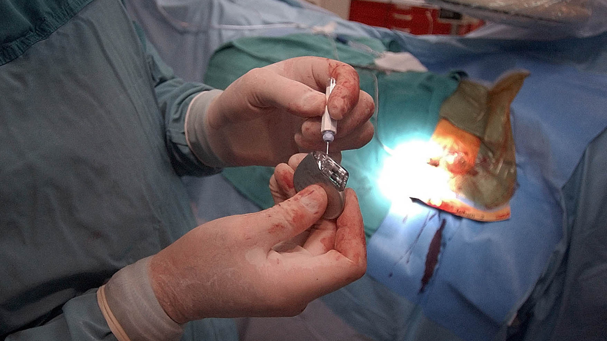  A doctor is shown preparing to implant a brand-new pacemaker into a patient at Medical City Hospital in Dallas. In the United States it is illegal to reuse such medical implants. (AP Photo/LM Otero, file) 