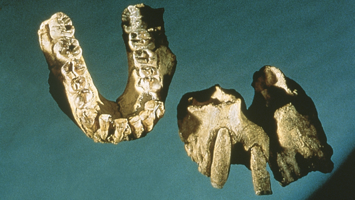   Patients with periodontitis, a form of gum disease, have both inflammation and bone loss. (Felix E. Guerrero/https://flic.kr/p/78VAWD) 