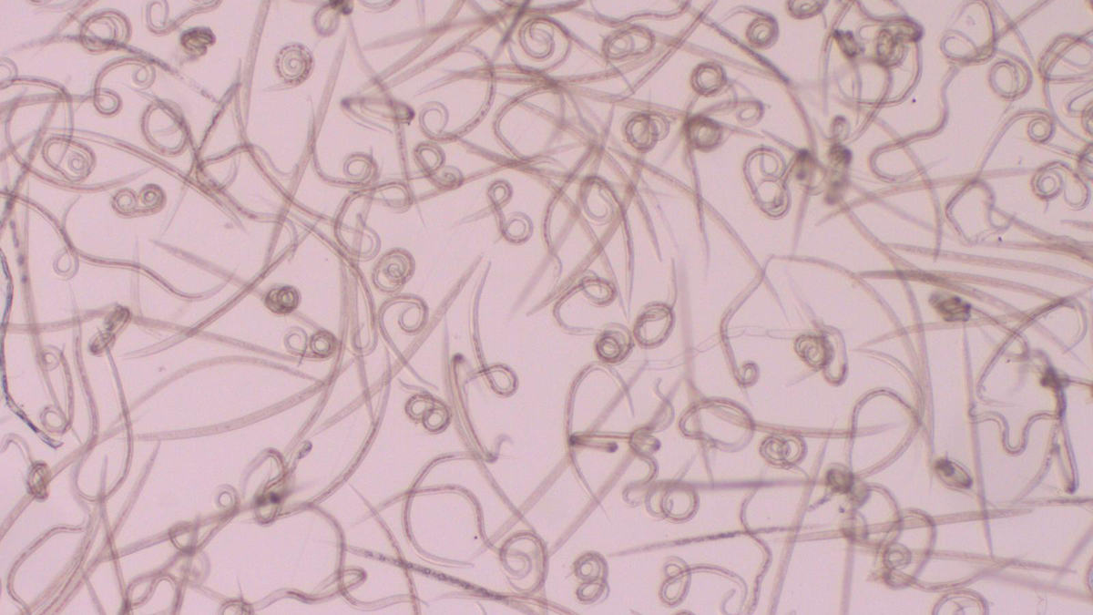  Biologists want to better understand how worm infections influence the body's ability to fight off other infections. (Image courtesy of Isabella Cattadori, Penn State's Center for Infectious Disease Dynamics) 