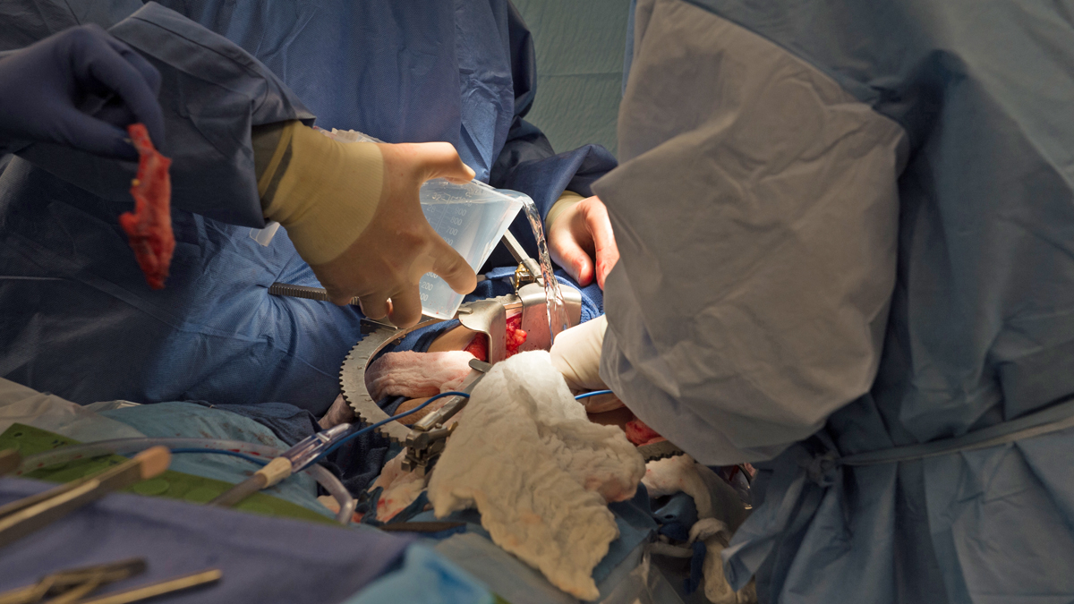  Dr. Matthew Cooper, (left) and  Dr. Seyed Ghasemian transplant a donated kidney into Brenda Hudson at MedStar Georgetown University Hospital in Washington, Tuesday, June 28, 2016.  More than 120,000 people are on the nation’s waiting list for an organ transplant, most of them for kidneys, and thousands die before receiving one because of a dire shortage of donors.  (Molly Riley/AP Photo) 