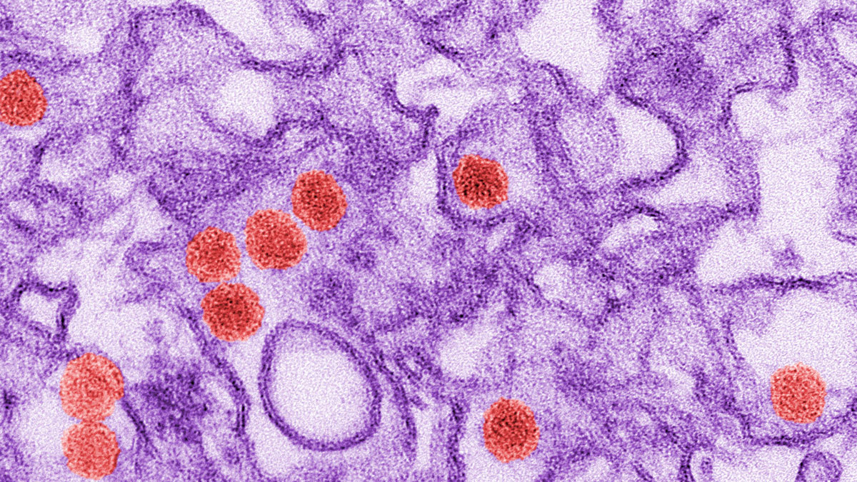  This 2016 digitally-colorized electron microscope image made available by the Centers for Disease Control and Prevention shows the Zika virus, in red. (Cynthia Goldsmith/CDC via AP) 