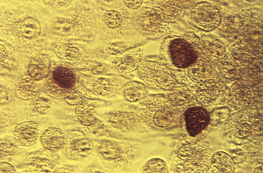 STD Cases This 1975 microscope image made available by the the Centers for Disease Control and Prevention shows Chlamydia trachomatis bacteria magnified 200X. (Dr. E. Arum, Dr. N. Jacobs/CDC via AP)