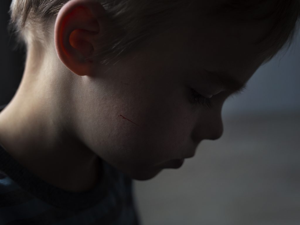 According to estimates by the U.S. Department of Agriculture, nearly a quarter of children growing up in rural America were poor in 2016, compared to slightly more than 20 percent in urban areas. According to estimates by the U.S. Department of Agriculture, nearly a quarter of children growing up in rural America were poor in 2016, compared to slightly more than 20 percent in urban areas.
(Getty Images)