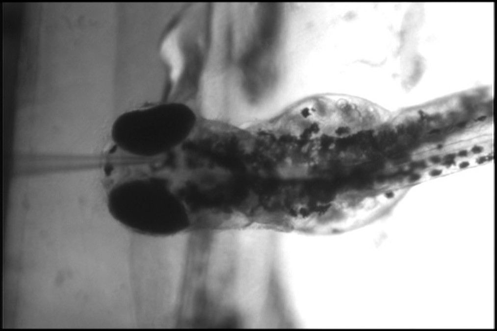 ZebrafishLarva01 A zebafish larva sits in agarose gel to stabilize it on a glass microscope slide. A microelectrode, which looks like a needle point, measures electricity in its brain, telling scientists how often and how severe its seizures are