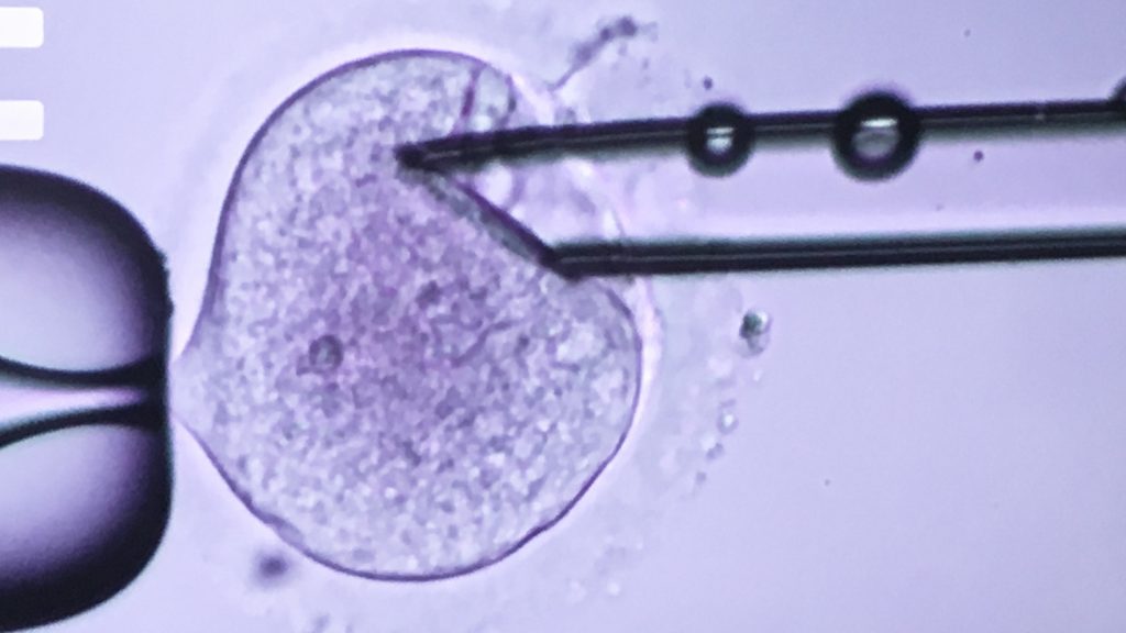 A scientist from the Nadiya Clinic in Kiev, Ukraine inserts a needle into a fertilized egg to extract the DNA of a man and woman trying to have a baby. The clinic is combining the DNA from three different people to create babies for women who are infertile.
A clinic's embryo scientist inserts a needle into a fertilized egg (pictured) to extract the DNA of a man and woman trying to have a baby. He'll then transfer the DNA into a fertilized egg from an egg donor that has had most of its DNA removed. That creates an embryo with DNA from three different people. (Rob Stein/NPR)