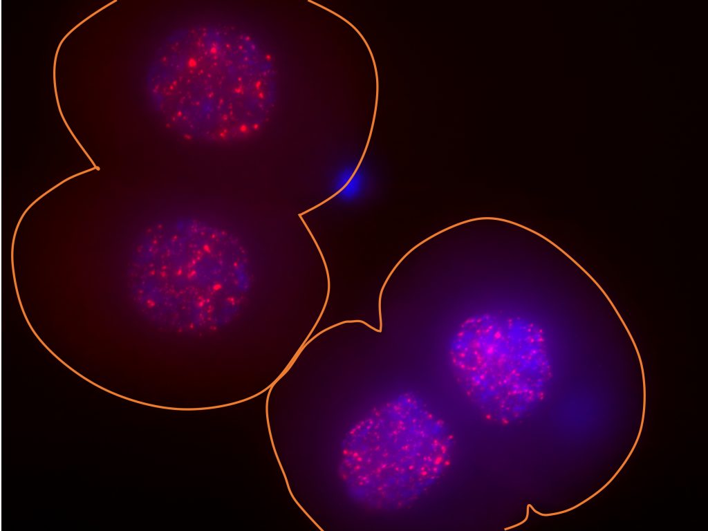 In these two two-cell mouse embryos, the surface of the embryos is outlined in orange, the DNA in the nucleus is indicated in blue and the activity of the LINE-1 gene is indicated via bright red spots. In these two two-cell mouse embryos, the surface of the embryos is outlined in orange, the DNA in the nucleus is indicated in blue and the activity of the LINE-1 gene is indicated via bright red spots. (Ramalho-Santos lab/UCSF)