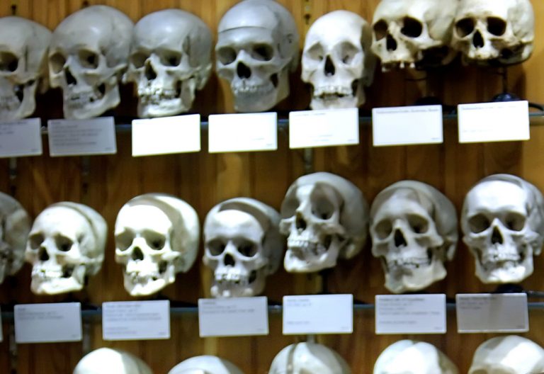 Several human skulls on display as part of the exhibit