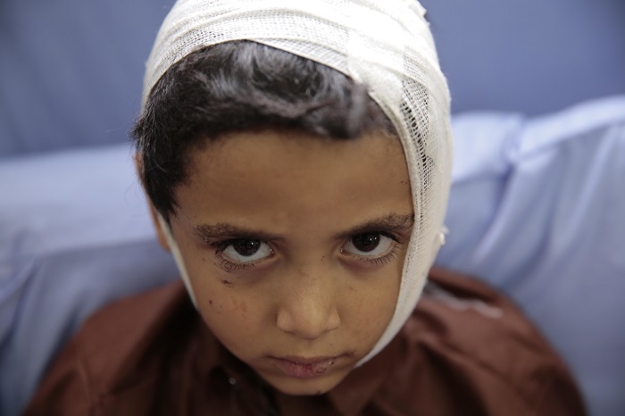 A child injured in a deadly Saudi-led coalition airstrike on Thursday rests in a hospital in Saada, Yemen, Sunday, Aug. 12, 2018. Yemen's shiite rebels are backing a United Nations' call for an investigation into the airstrike in the country's north that hit a bus carrying civilians, many of them school children in a busy market, killing dozens of people including many children. (AP Photo/Hani Mohammed)