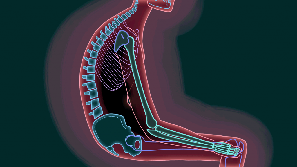 bad sitting posture (Lily Padula/NPR)