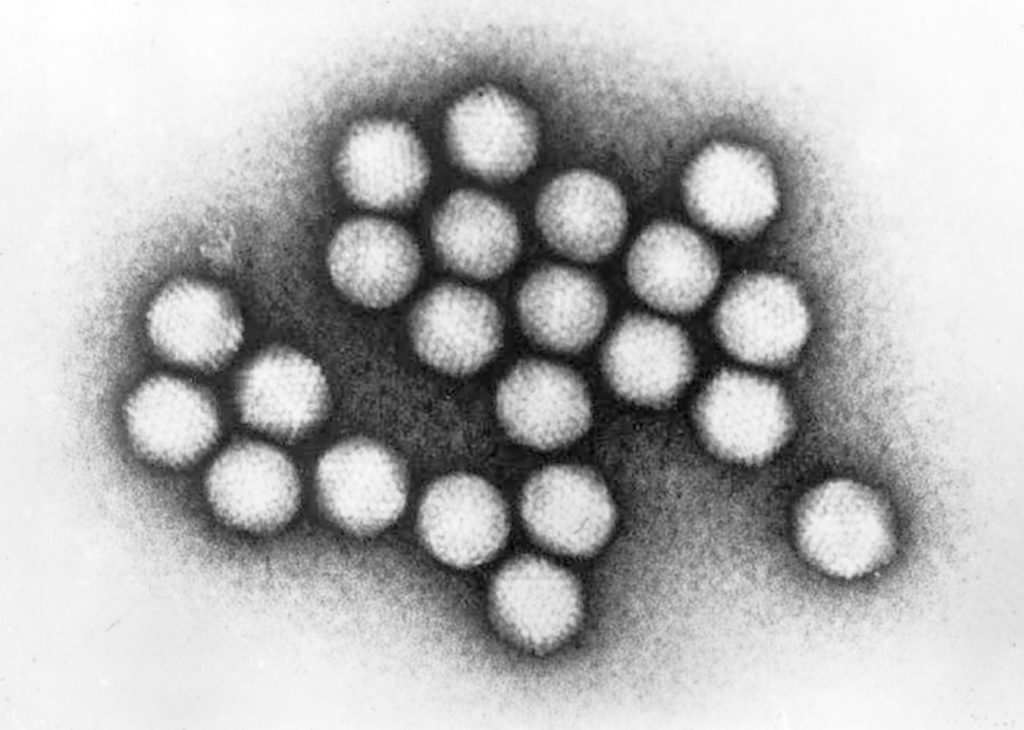 Science Says Viral Outbreak This 1981 electron microscope image made available by the Centers for Disease Control and Prevention shows a group of adenovirus virions. The adenovirus 7 strain, a common virus blamed for a deadly outbreak at a New Jersey children's rehabilitation center in October 2018, usually poses little risk for healthy people but can lead to dangerous pneumonia in already frail patients. (CDC via AP)