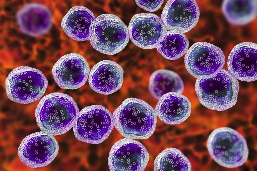 Computer illustration of malignant B-cell lymphocytes seen in Burkitt’s lymphoma, the most common childhood cancer in sub-Saharan Africa. Computer illustration of malignant B-cell lymphocytes seen in Burkitt's lymphoma, the most common childhood cancer in sub-Saharan Africa. (Kateryna Kon/Science Photo Library/Getty Images)