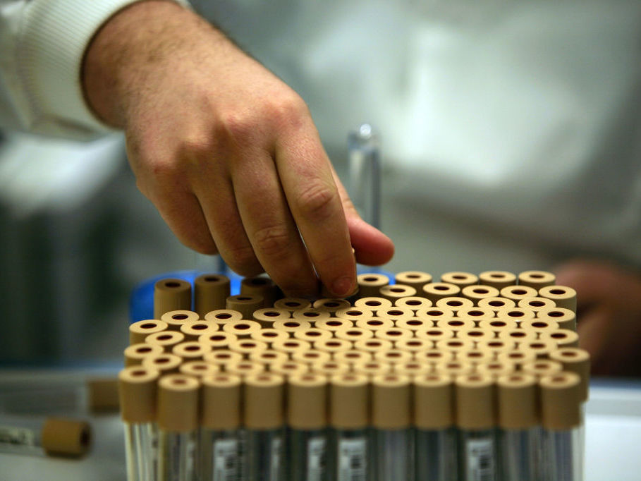 Researchers looked for genetic variants linked to sexual behavior in new genetic research that analyzed DNA from donated blood samples from nearly half a million middle-aged people from Britain who participated in a project called the UK Biobank. Researchers looked for genetic variants linked to sexual behavior in new genetic research that analyzed DNA from donated blood samples from nearly half a million middle-aged people from Britain who participated in a project called the UK Biobank. (Christopher Furlong/Getty Images)
