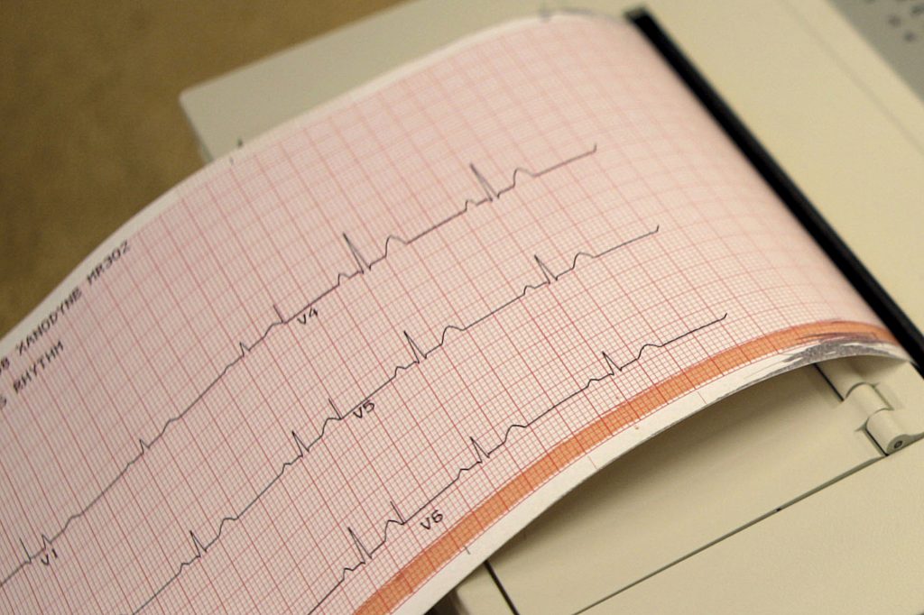 New Heart Drugs This May 26, 2009 file photo shows a printout from an electrocardiogram machine in Missouri. Doctors are reporting that novel drugs may offer fresh ways to reduce heart risks beyond the usual medicines to lower cholesterol and blood pressure. One new study found that heart attack survivors benefited from a medicine long used to treat gout. Gene-targeting medicines also showed promise in studies discussed Monday, Nov. 18, 2019, at an American Heart Association conference in Philadelphia. (Jeff Roberson/AP Photo)