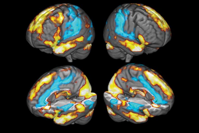 An image from neuroscientist Glenn Fox's study on the neural correlates of gratitude. (Image courtesy of Glenn Fox)