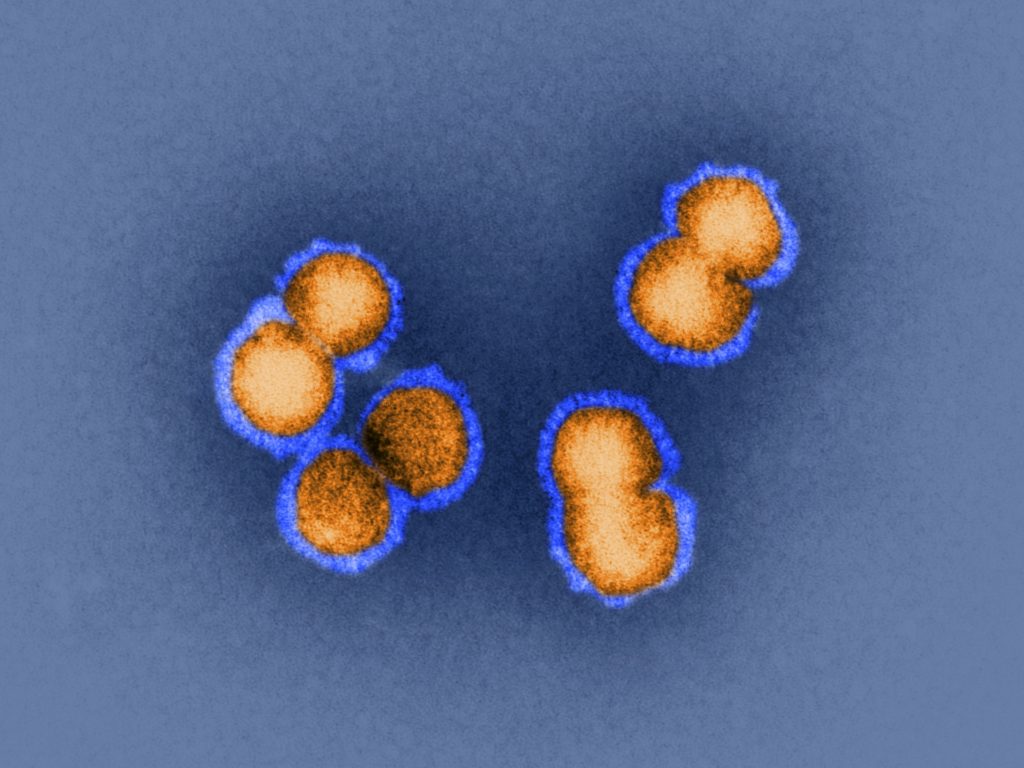 H5N1 bird flu virus is the sort of virus under discussion this week in Bethesda, Md. How animal viruses can acquire the ability to jump into humans and quickly move from person to person is exactly the question that some researchers are trying to answer by manipulating pathogens in the lab. H5N1 bird flu virus is the sort of virus under discussion this week in Bethesda, Md. How animal viruses can acquire the ability to jump into humans and quickly move from person to person is exactly the question that some researchers are trying to answer by manipulating pathogens in the lab. (SPL/Dr. Klaus Boller/Science Source)