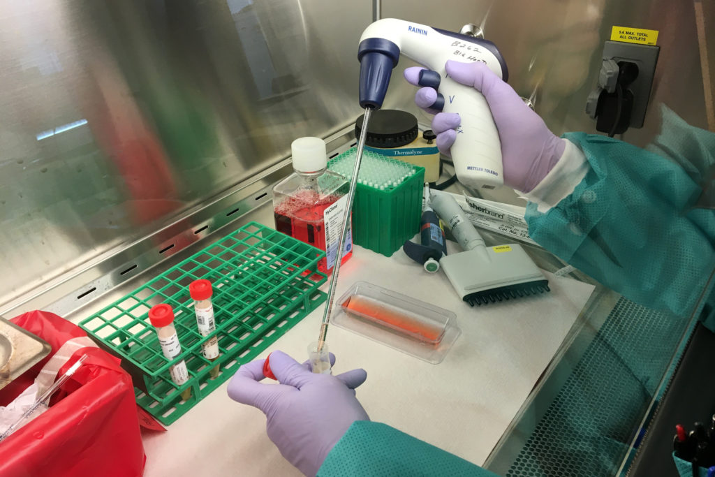 Virus Outbreak Pennsylvania and New Jersey officials disclosed additional presumed positive cases of coronavirus Sunday, bringing each state’s totals to six. (California Department of Public Health via AP Photo)
