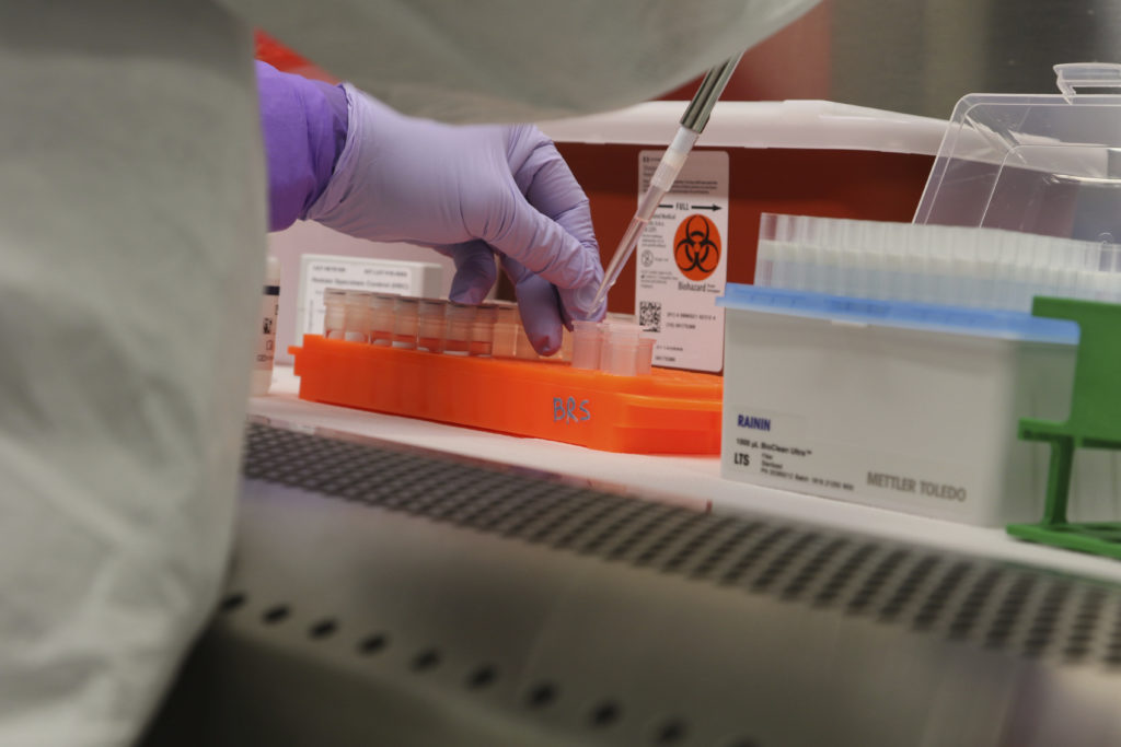 Virus Outbreak-Hawaii Hawaii state Department of Health microbiologist Mark Nagata demonstrates the process for testing a sample for coronavirus at the department's laboratory in Pearl City, Hawaii on Tuesday, March 3, 2020. (Audrey McAvoy/AP Photo)