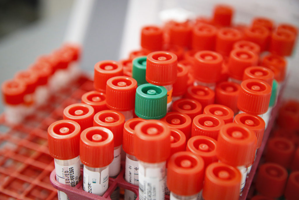 Virus Outbreak New York A laboratory technician prepares COVID-19 patient samples for semi-automatic testing at Northwell Health Labs, Wednesday, March 11, 2020, in Lake Success, N.Y. The US Food and Drug Administration has approved faster testing protocols as the viral outbreak continues to spread worldwide. For most people, the new coronavirus causes only mild or moderate symptoms. For some it can cause more severe illness. (AP Photo/John Minchillo)