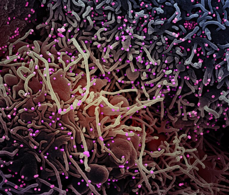 This image made by a scanning electron micrograph shows SARS-COV-2 virus particles (colorized pink) from a patient sample. There are various studies looking at changes to the virus genome — and the possible impact on how the virus affects humans. (NIAID/NIH)