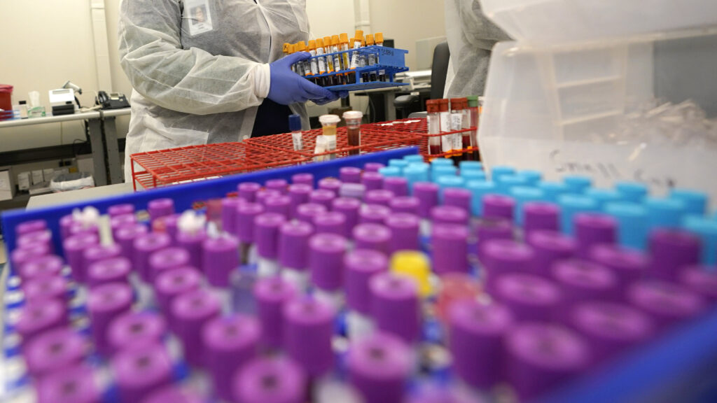 Julie Janke, a medical technologist at Principle Health Systems and SynerGene Laboratory, helps sort samples for different tests Tuesday, April 28, 2020, in Houston. (AP Photo/David J. Phillip)