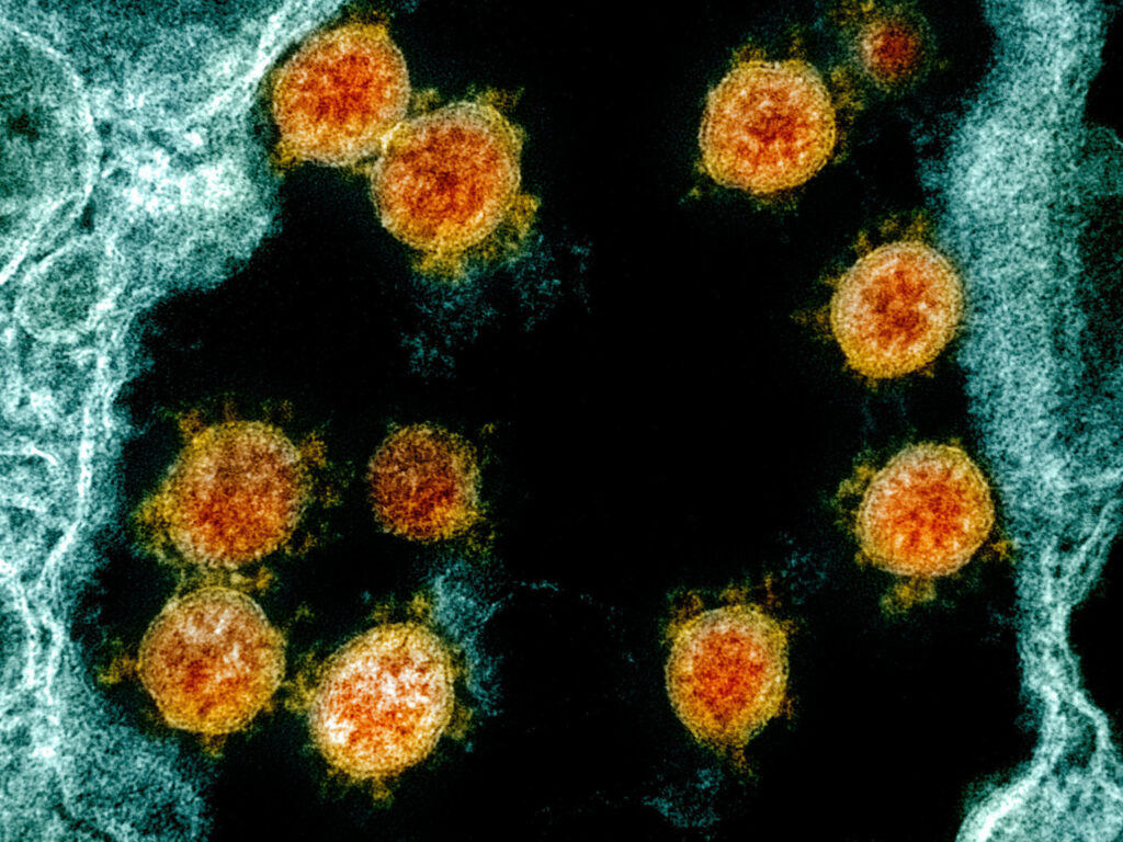 Internationally, scientists now have on file the genomes of more than 47,000 different samples of the virus that causes COVID-19 — up from just one in January. Here’s a transmission electron micrograph of SARS-CoV-2 virus particles (orange) isolated from a patient. Internationally, scientists now have on file the genomes of more than 47,000 different samples of the virus that causes COVID-19 — up from just one in January. Here's a transmission electron micrograph of SARS-CoV-2 virus particles (orange) isolated from a patient.
(National Institute of Allergy and Infectious Diseases/National Institutes of Health)