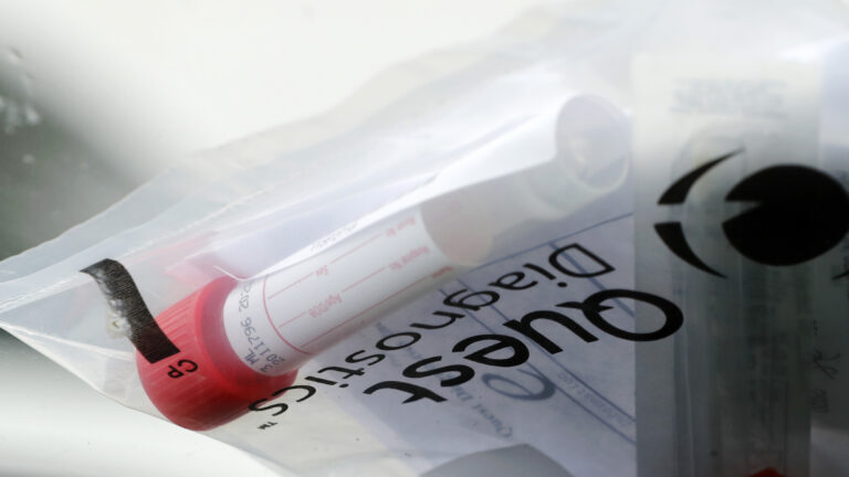 A testing kit sits on the windshield of a car as it passes through a drive-through COVID-19 testing site set up in St. Charles, Mo. (Jeff Roberson/AP Photo)