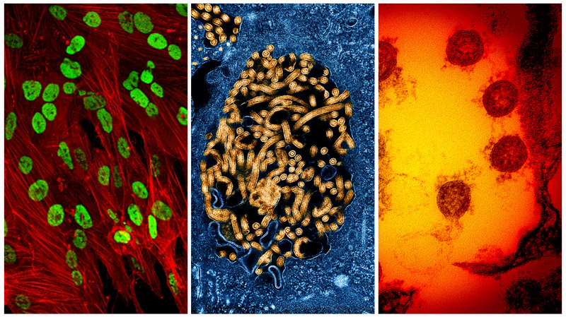 From left: Colorized transmission electron micrograph of herpes simplex virus, Ebola virus and SARS-CoV-2 virus particles. Researchers now believe the coronavirus is likely to be a continuing threat until a vaccine is developed.
NIAID; NIH; NIH