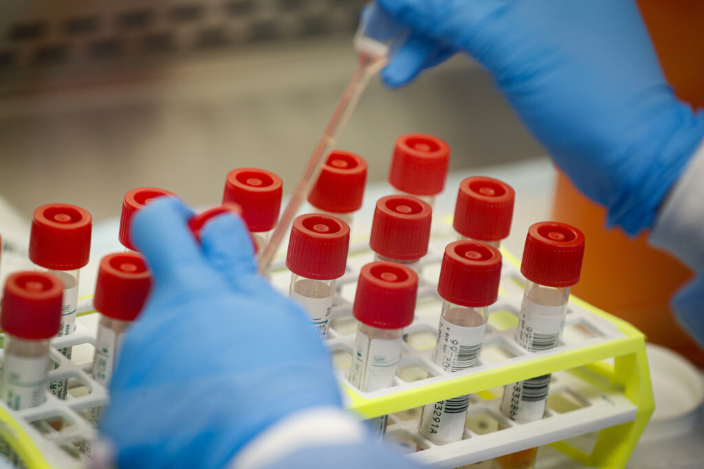 Coronavirus patient samples Coronavirus patient samples