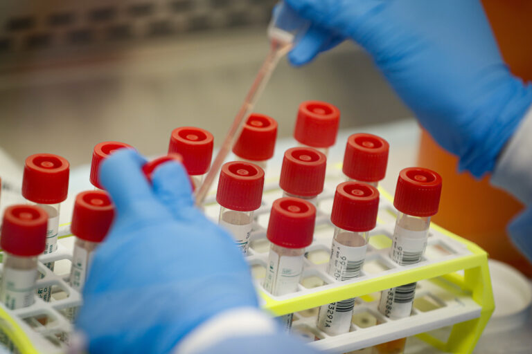 Coronavirus patient samples