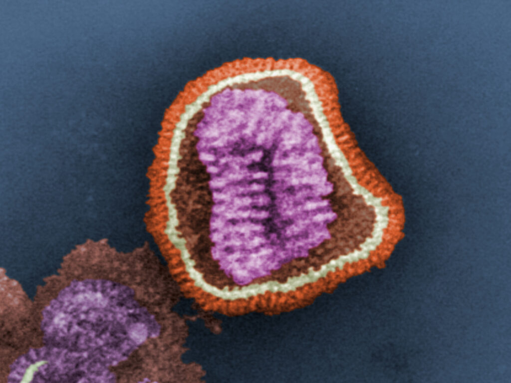 This negative-stained transmission electron micrograph (TEM) depicts the ultrastructural details of an influenza virus particle, or “virion”. A member of the taxonomic family Orthomyxoviridae, the influenza virus is a single-stranded RNA organism. The influenza virus. (Frederick Murphy/CDC)