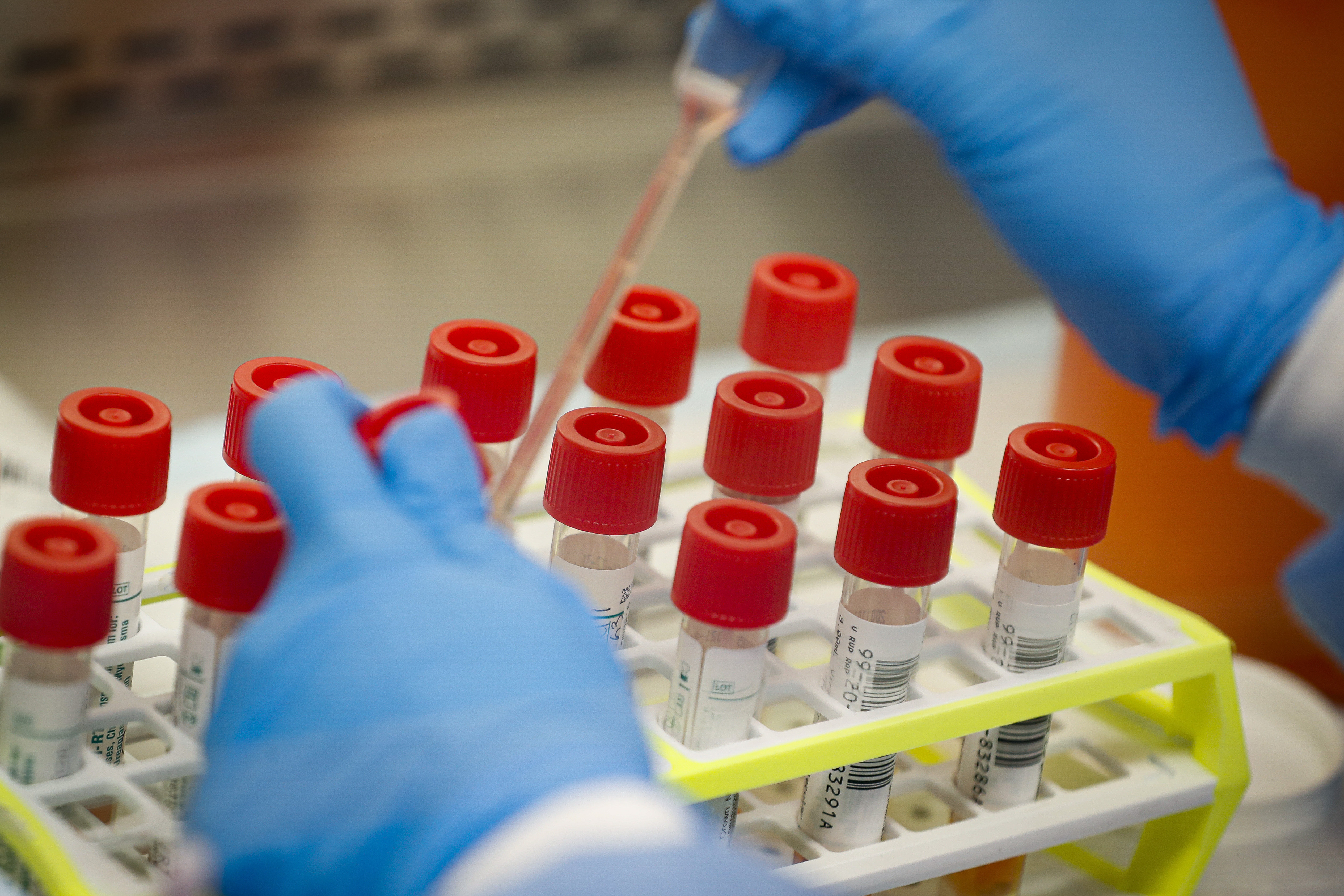 A technician prepares coronavirus test samples on New York's Long Island. The head of New York City's public labs said fighting the virus without a test was like building a house with a saw but no hammer.