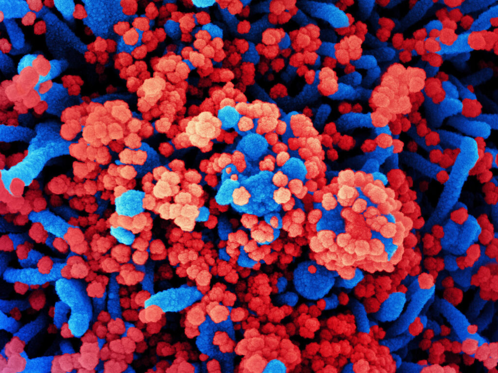 sars-cov2-1-f9eb28d7b787fedde6ec7af7f988c53bb7fd697f-s1600-c85 SARS-CoV-2 virus particles, shown in red, have heavily infected a cell in this colorized scanning electron micrograph.