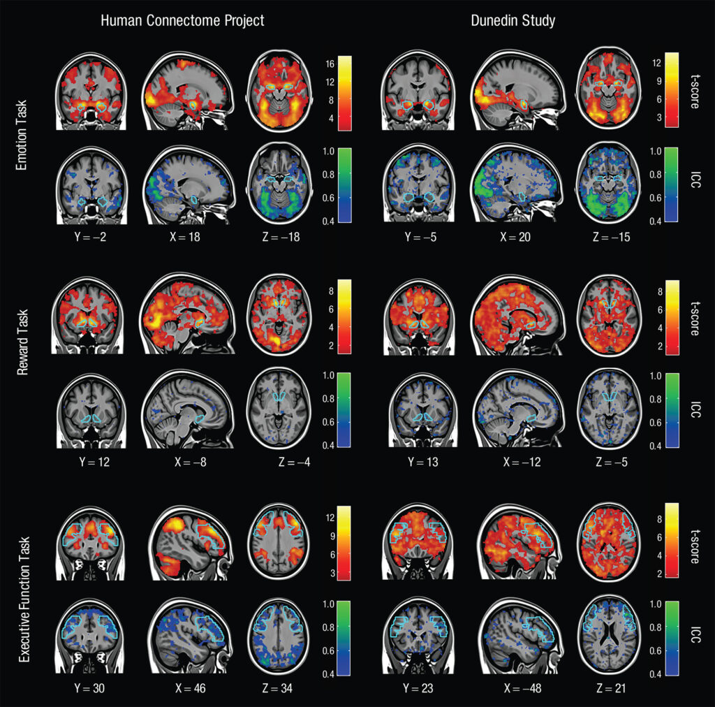 233673 A series of brain scan images against a black background. Brain scans showing MRI mapping for 3 tasks across 2 different days. Warm colors show how the results hold up in groups. Cool colors show how results are less reliable person to person. Photo credit: Annchen Knodt/Duke University.