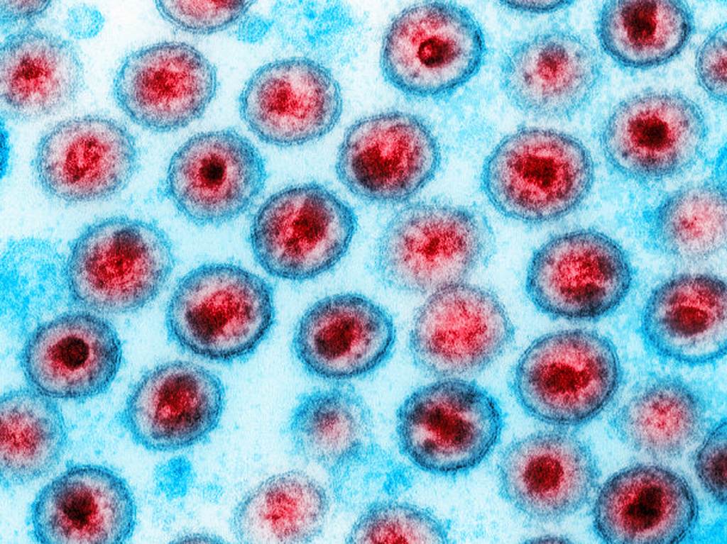 Transmission electron micrograph of AIDS, HIV-1 A computer-enhanced image of the HIV virus.