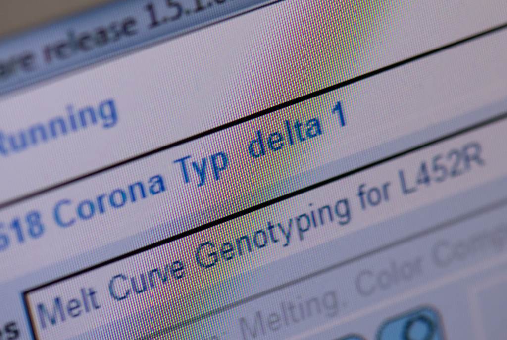 The delta variant, first detected in India, is spreading across the globe and is now the dominant variant in the U.S., according to estimates by the CDC. The delta variant, first detected in India, is spreading across the globe and is now the dominant variant in the U.S., according to estimates by the CDC. (Boris Roessler/DPA/Picture Alliance via Getty)
