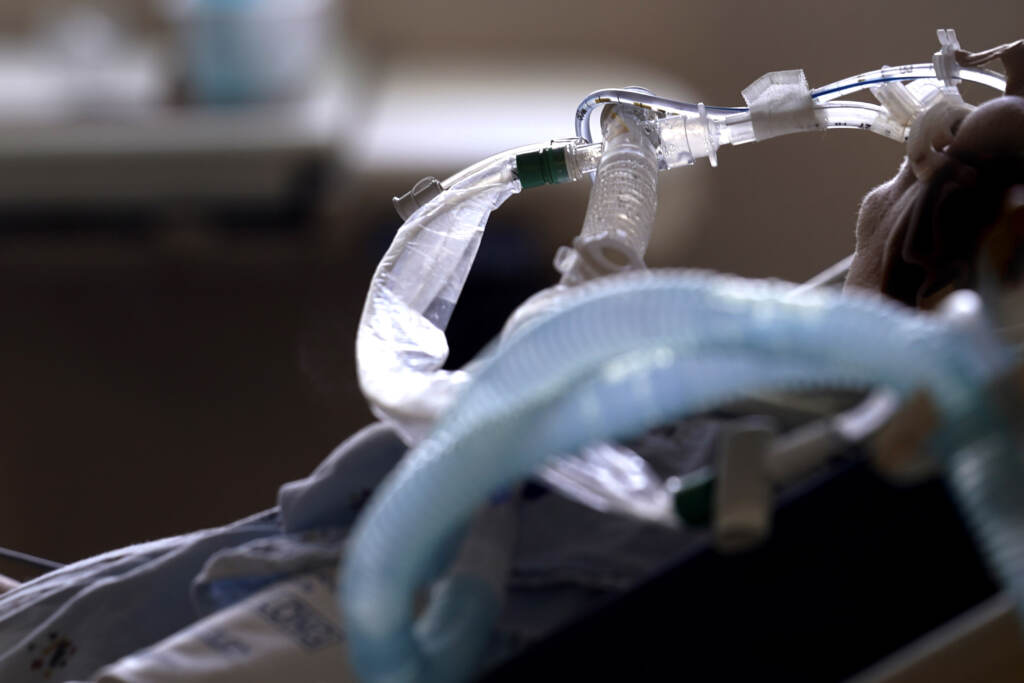 A patient with COVID-19 on breathing support lies in a bed in an intensive care unit