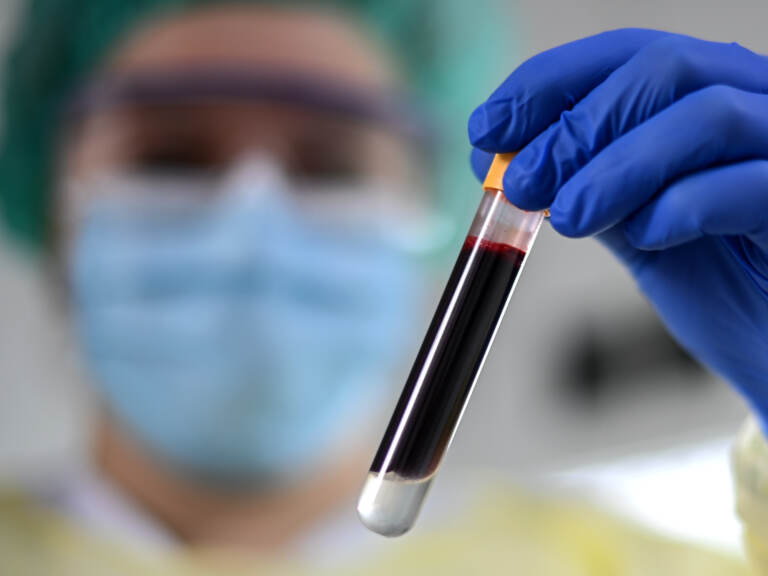 Carolyn Krause, study assistant, holds a blood sample in her hand.