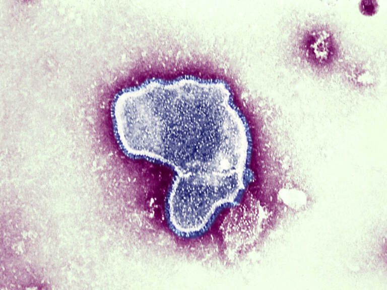 At the moment there is little data available on the impact of contracting COVID-19 and the respiratory syncytial virus (pictured), and whether together they can make a person sicker. But health officials worry it could put young patients — who are not eligible for the coronavirus vaccine — at greater risk. (BSIP/UIG Via Getty Images/Universal Images Group via Getty)