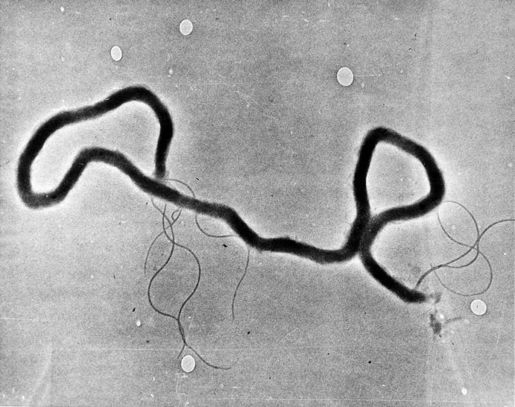 Syphilis Outbreak-Things To Know The organism treponema pallidumch is seen through an electron microscope