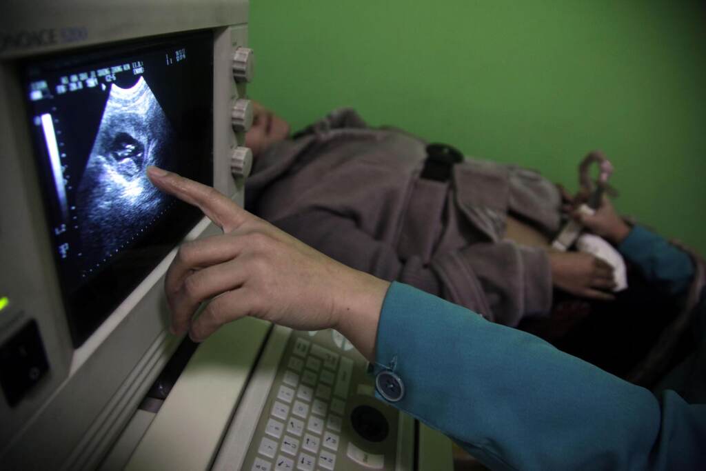 China Abortions A doctor performs an ultrasound scan. It’s possible to prevent congenital syphilis from being passed to a fetus during pregnancy, yet rates of congenital syphilis have been rising at alarming rates. (AP Photo/Ng Han Guan)